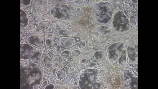 Heart Cells derived from iPSC Stem Cells beat in Culture Dish [upl. by Narcis]