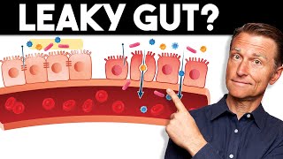 7 Signs of a Leaky Gut — Dr Berg [upl. by Sherborne696]