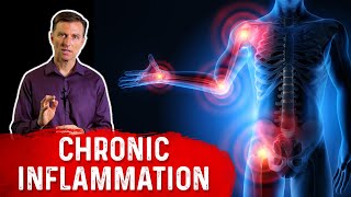 The Big Problems with Chronic Inflammation [upl. by Catarina877]