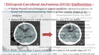 ICU Management of Subarachnoid Hemorrhage by Amedeo Merenda MD [upl. by Cyndie497]