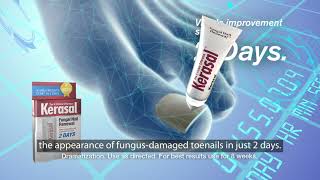 Kerasal® Fungal Nail Renewal™ Improves Appearance of Discolored or Damaged Nails [upl. by Annoyek69]