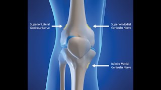 GENICULAR NERVE BLOCK [upl. by Nialb933]