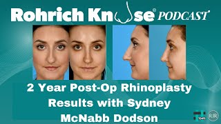 Two Year PostOp Rhinoplasty Results with Sydney McNabb Dodson [upl. by Asreht]