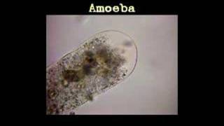 MicroSafari  Amoeba [upl. by Spurgeon]