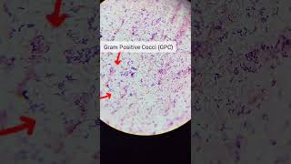 gram positive cocci GPC gram negative bacillignb [upl. by Behrens672]