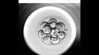 Embryoscope 2  Nuevo método de cultivo y selección embrionaria [upl. by Clementina]