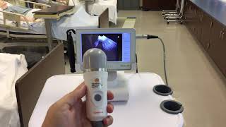 Caresono Bladder Scanner HowTo [upl. by Einej]