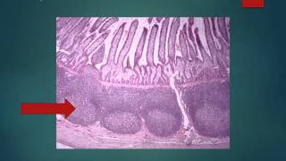 Histología del Intestino delgado y grueso [upl. by Nerra]