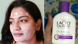 Lacto Calamine Face Lotion Uses Review in Telugu [upl. by Basile]