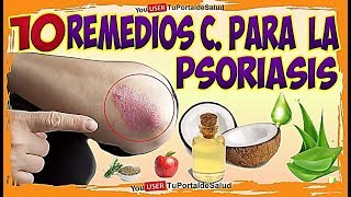 10 Remedios Caseros para la Tratar la PsoriasisRemedios Naturales Psoriasis [upl. by Ellenig]