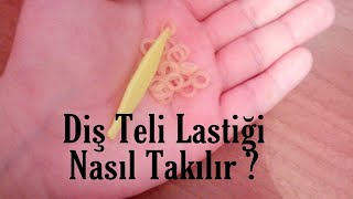 Diş Teli Lastiği Nasıl TakılırampDiş Teli Varken Dişleri Nasıl FırçalamalıyızampGÜNLÜK VLOG AKŞAM RUTİNİ [upl. by Rebmyt839]