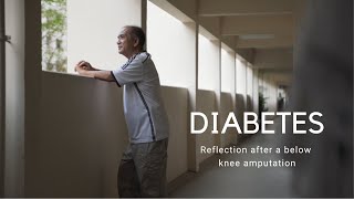 Diabetes Reflection after a below knee amputation [upl. by Bomke]