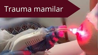 tratamento laserterapia trauma mamilar 🤰🤱 [upl. by Beverlee]