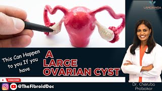 This Can Happen to you If you have A Large Ovarian Cyst  TheFibroidDoc  Dr Cheruba Prabakar [upl. by Anderson47]