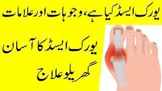 Uric Acid Symptoms and Treatment Permanently in Urdu [upl. by Vizza563]