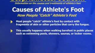 Causes Of Athletes Foot [upl. by Anifesoj324]