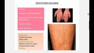 Ichthyosis Vulgaris [upl. by Sivahc]