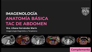 TAC DE ABDOMEN  ANATOMÍA RADIOLÓGICA BÁSICA [upl. by Navac]