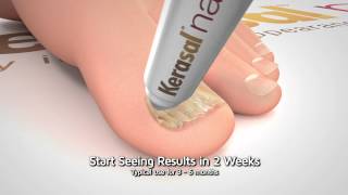 Kerasal Nail Restore Healthy Nail Appearance 15 Sec [upl. by Aelsel]