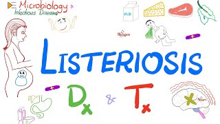 Listeria monocytogenes Listeriosis  Diagnosis and Treatment  Microbiology 🧫 [upl. by Newfeld]