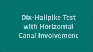 DixHallpike Test with Horizontal Canal Involvement [upl. by Lletnahs29]