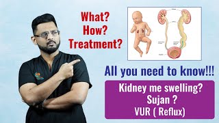 What is VUR Reflux  बच्चो के किडनी मे सूजन  कारण इलाज  Vesicoureteric reflux [upl. by Carlin927]