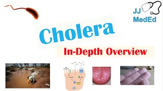 Cholera Vibrio Cholerae Pathophysiology Risk Factors Symptoms Diagnosis and Treatment [upl. by Isabelita]