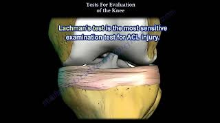 Tests For Examination Of The Knee Everything You Need To Know Dr Nabil Ebraheim [upl. by Clarance576]