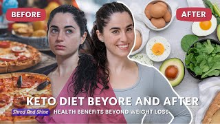 Keto Diet Before and After Health Benefits Beyond Weight Loss [upl. by Nochur857]