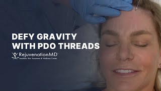 NonSurgical Brow Lift with PDO Threads [upl. by Eclud217]