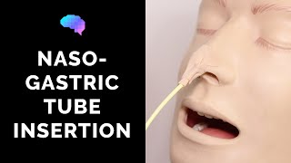 Nasogastric NG Tube Insertion  OSCE Guide  UKMLA  CPSA [upl. by Moreland729]