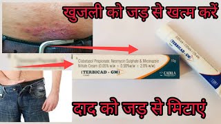 बड़े से बड़े दाद और खुजली को करे खत्म ।। Terbicad GM cream full review in hindi 2023 [upl. by Homere]