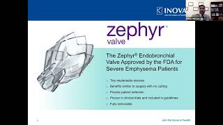 How It Works Dr Mahajan Explains the Zephyr Valve [upl. by Naerb789]