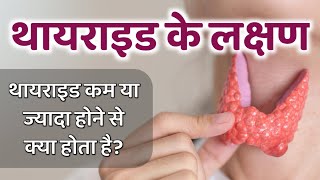 थायराइड के लक्षण  Hypothyroidism  Hyperthyroidism  Thyroid Disease Symptoms [upl. by Blus]