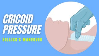 Cricoid pressure  Technique [upl. by Lance157]