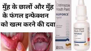 Nuforce Mouth Paint BenefitsClotrimazole Mouth PaintOral Fungul Infectionछाले व सफेद फफूंदshort [upl. by Christos]