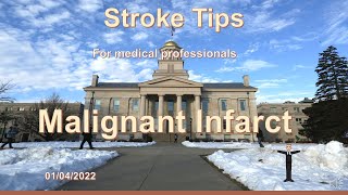 Stroke Tips Malignant Hemisphere infarct [upl. by Kruse]