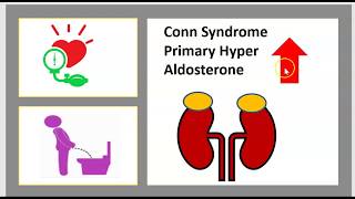 Metabolic Alkalosis Bartter Syndrome Gitelmans Liddles Conns Arthrogryposis Gordons Usmle Nclex [upl. by Oyek]