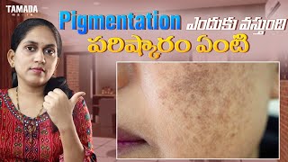 Pigmentation Causes treatment Online Beautician Course by Divya [upl. by Nisa]