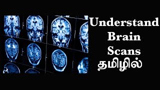 தொழில்நுட்ப்பத்தின் மூலம் மூளையைப்புரிந்துகொள்ளும் முறை Ep8 Basic Psychology in Tamil [upl. by Annauqahs]