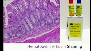 5 Hematoxylin and Eosin staining  HampE MLTLectures [upl. by Whitelaw944]