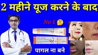 Honest Review Cosmelite Next Cream Cosmelite Cream के फायदे हिंदी में Cosmelite Next Cream 2023 [upl. by Aitrop86]