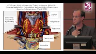 Surgical Treatment for Papillary Thyroid Cancer  Contra Central Neck Dissection [upl. by Middle]