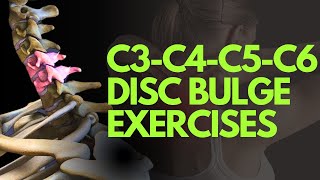 c3c4c5c6 disc bulge exercises in telugu by Nityal Physio [upl. by Maryn]