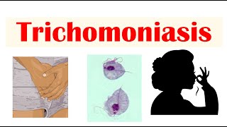 Trichomoniasis Common STI  Causes Symptoms amp Complications Cancer Diagnosis Treatment [upl. by Bassett929]