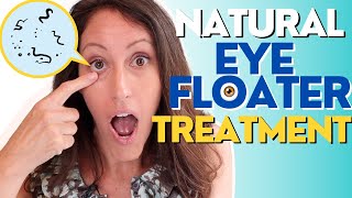 Natural Eye Floater Treatment  4 Ways to Treat Eye Floaters [upl. by Phippen]