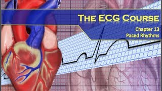 The ECG Course  Paced Rhythms [upl. by Ajnek]