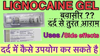 Lignocaine hydrochloride jelly  Xylocaine jelly  Uses Side effects  Lox 2 jelly Medicine [upl. by Landing]