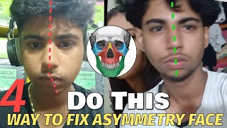 How i Fix My Facial Asymmetric Facial Asymmetrical In Hindi [upl. by Innos]