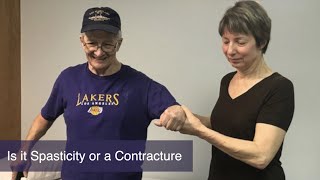 Is It Spasticity Or A Contracture [upl. by Hafinah]